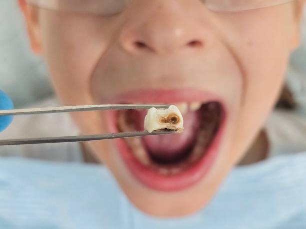 Best Urgent Tooth Repair  in Greenwood, SC
